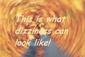 dizziness looks like