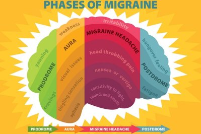 07182018_phases_of_migraine_Flickr.2e16d0ba.fill-735x490